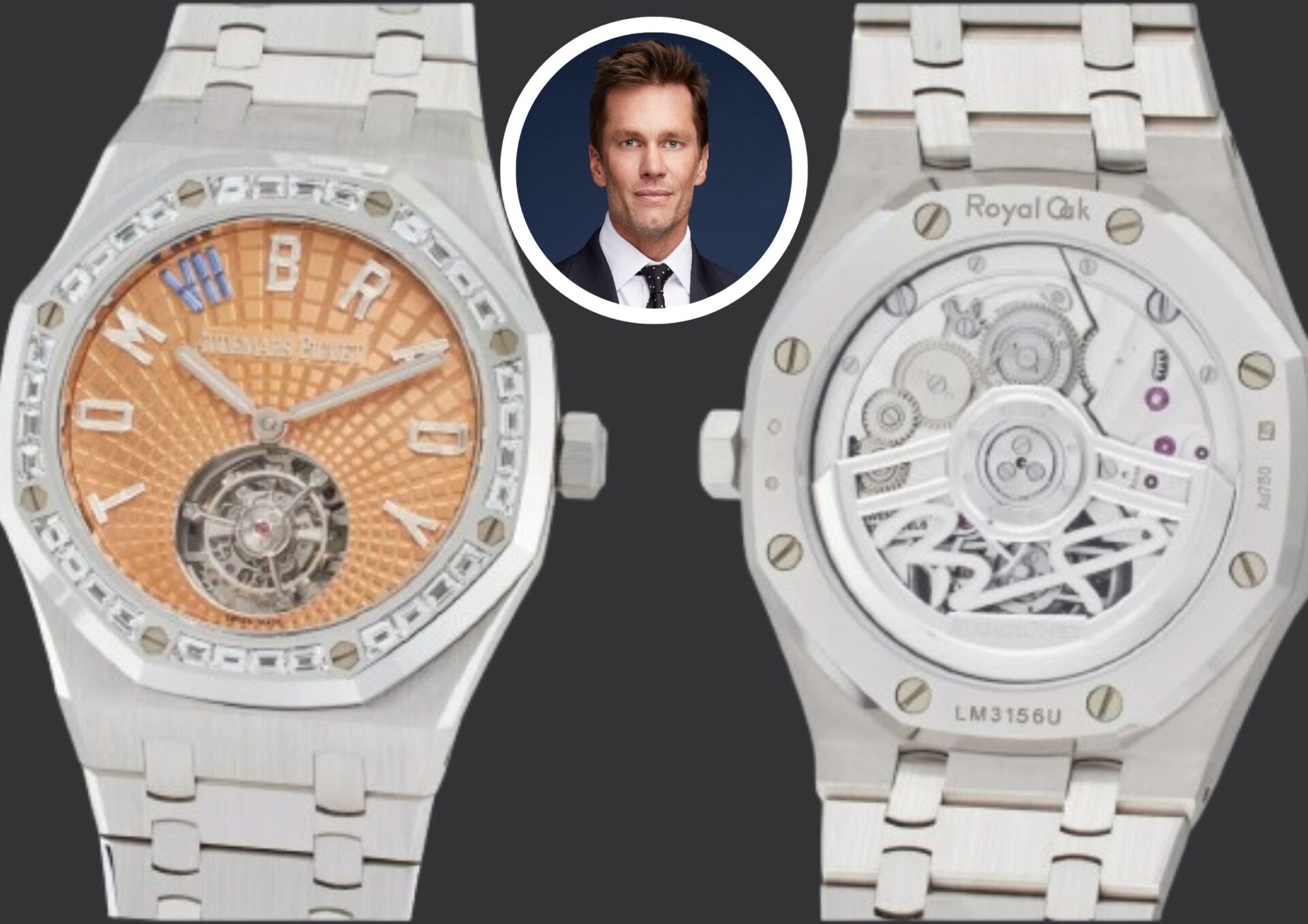 Tom Brady's Audemars Piguet, Rare Patek, and Other Prized Watches